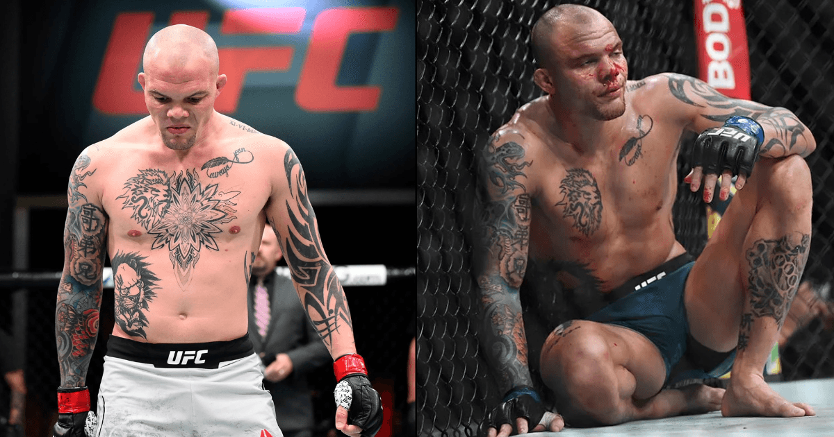 Anthony Smith Pleads Not Guilty to Felony Charges