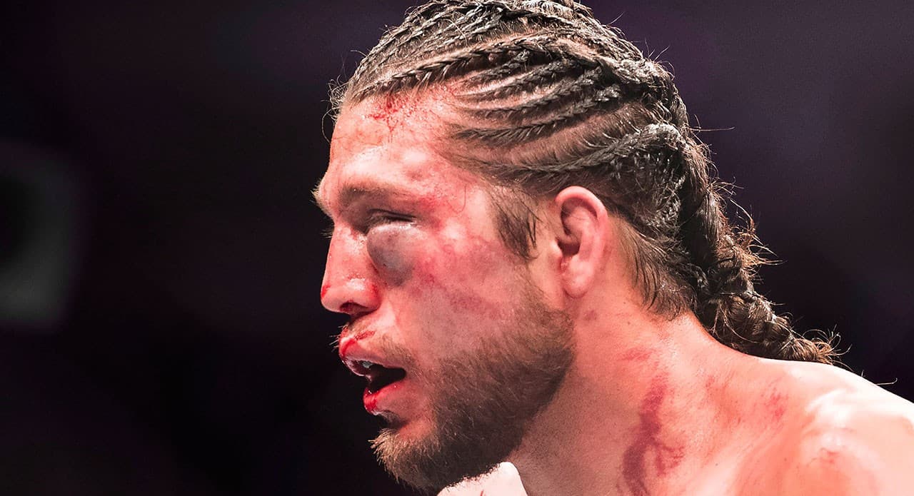 Brian Ortega Withdraws From UFC 331 Moicano Rematch With Cut